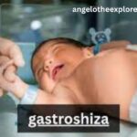 Gastroshiza: Causes, Symptoms, and Complete Guide